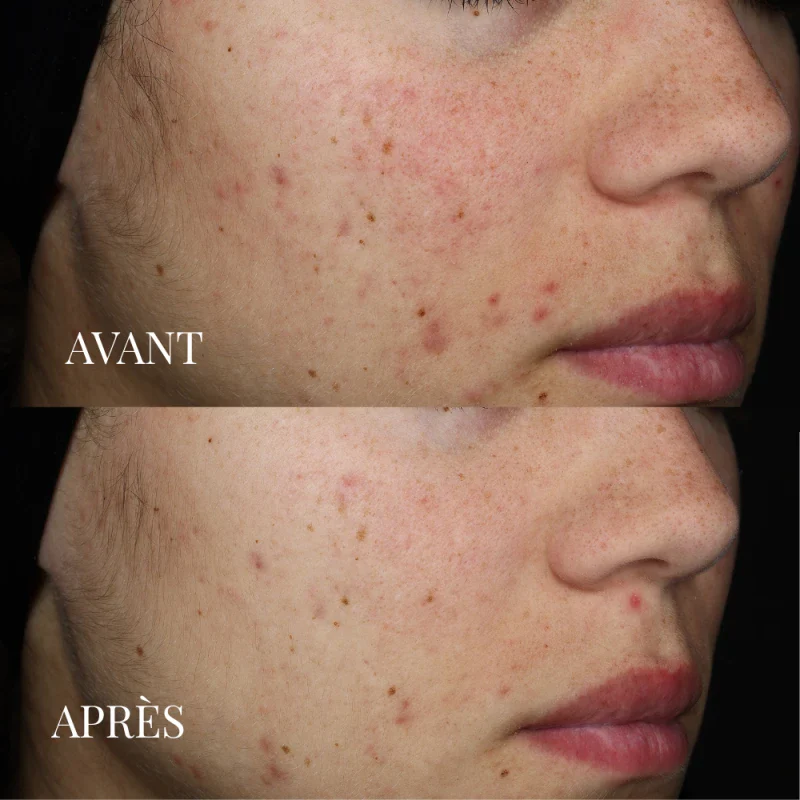 Masque soin détoxifiant à l'argile verte - Image 6