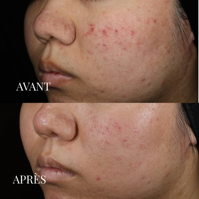 Masque soin détoxifiant à l'argile verte - Image 7