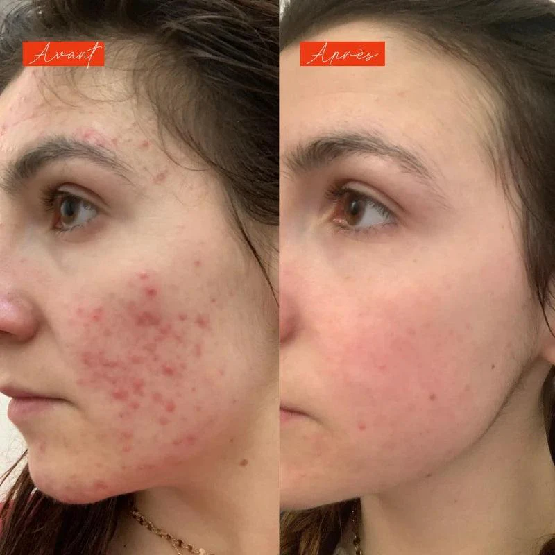 Sérum anti imperfections actif - Lundi matin - Image 2