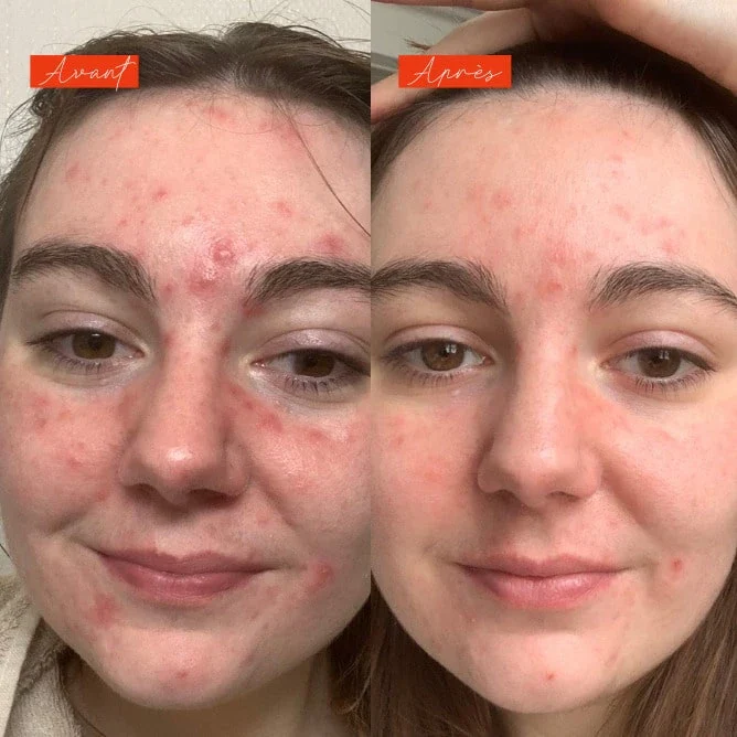 Sérum anti imperfections actif - Lundi matin - Image 7
