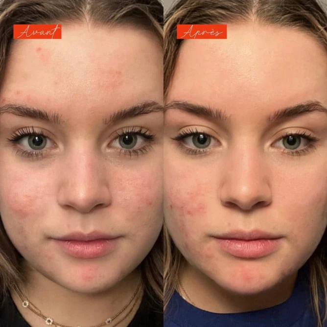 Sérum anti imperfections actif - Lundi matin - Image 8