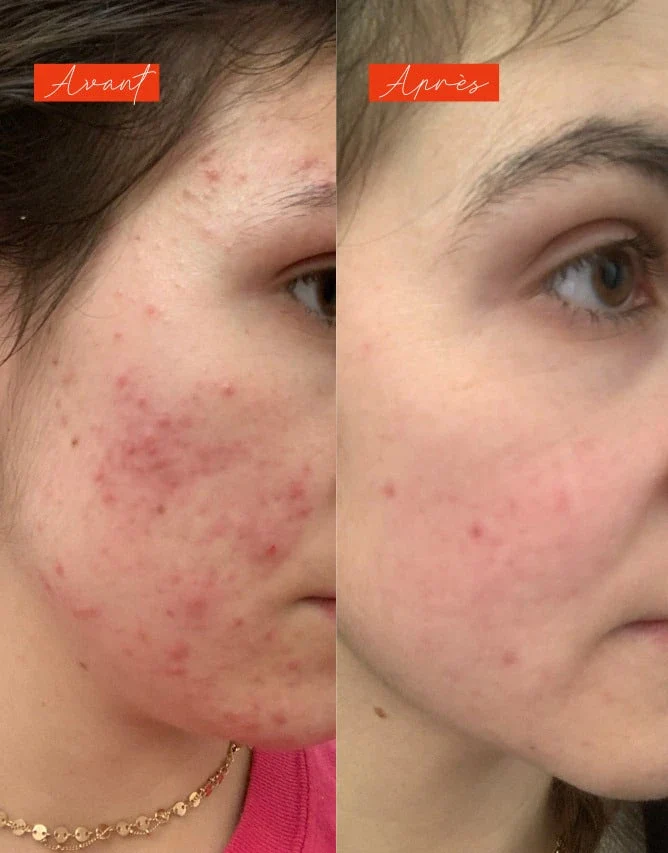 Sérum anti imperfections actif - Lundi matin - Image 9